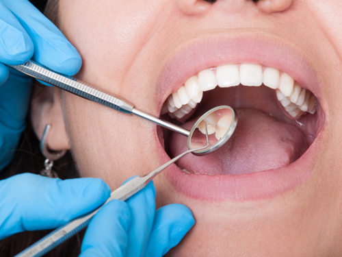 洗牙会导致牙齿敏感吗？