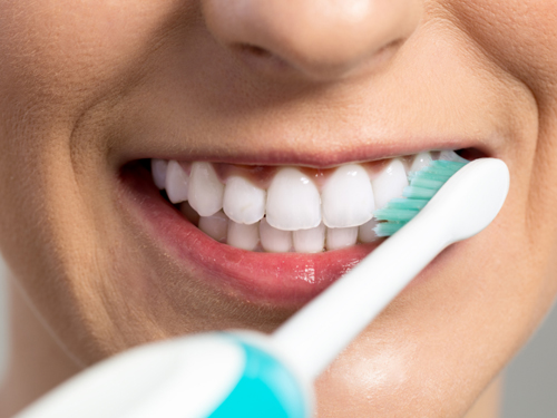 坚持刷牙能否代替洗牙？